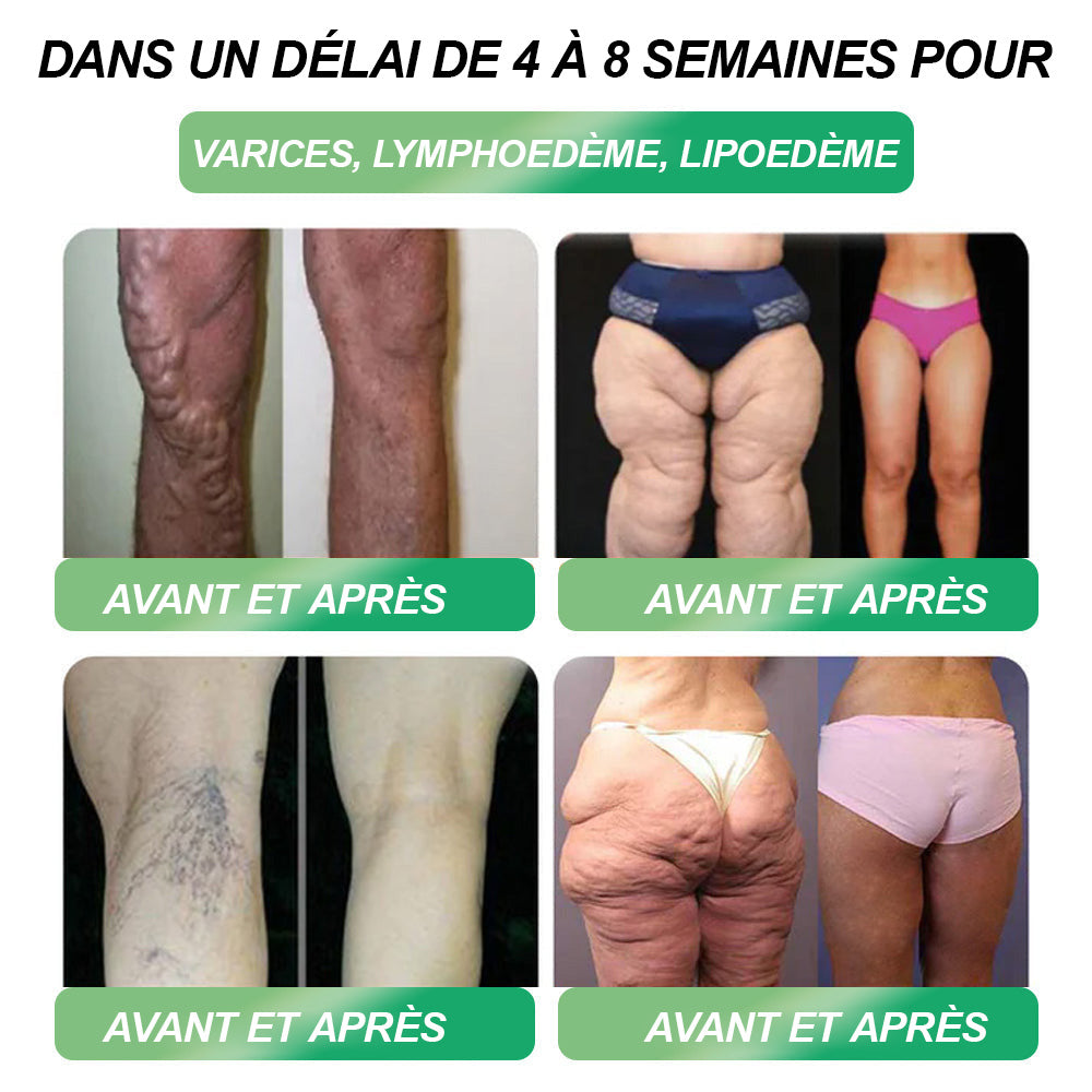𝑩𝒐𝒖𝒕𝒊𝒒𝒖𝒆 𝑶𝒇𝒇𝒊𝒄𝒊𝒆𝒍𝒍𝒆 | 𝙃𝐻𝑽𝖡®👨‍⚕️𝐺𝐿𝑃-𝟏 — 𝑺𝑶𝑳𝑼𝑻𝑰𝑶𝑵 𝑺𝑨𝑵𝑻𝑬́ 𝟔-𝑬𝑵-𝟏 (𝐔𝐧𝐞 𝐬𝐞𝐮𝐥𝐞 𝐝𝐨𝐬𝐞 𝐩𝐚𝐫 𝐣𝐨𝐮𝐫, 𝐝𝐞𝐬 𝐫𝐞́𝐬𝐮𝐥𝐭𝐚𝐭𝐬 𝐯𝐢𝐬𝐢𝐛𝐥𝐞𝐬 𝐞𝐧 𝐬𝐞𝐮𝐥𝐞𝐦𝐞𝐧𝐭 𝟕 𝐣𝐨𝐮𝐫𝐬) ✅ 𝐏𝐨𝐮𝐫 𝐥𝐞 𝐬𝐮𝐫𝐩𝐨𝐢𝐝, 𝐥𝐚 𝐬𝐚𝐧𝐭𝐞́ 𝐜𝐚𝐫𝐝𝐢𝐚𝐪𝐮𝐞, 𝐥𝐞 𝐝𝐢𝐚𝐛𝐞̀𝐭𝐞, 𝐥'𝐚𝐩𝐧𝐞́𝐞 𝐝𝐮 𝐬𝐨𝐦𝐦𝐞𝐢𝐥, 𝐥𝐞𝐬 𝐝𝐨𝐮𝐥𝐞𝐮𝐫𝐬 𝐚𝐫𝐭𝐢𝐜𝐮𝐥𝐚𝐢𝐫𝐞𝐬 𝐞𝐭 𝐩𝐥𝐮𝐬 𝐞𝐧𝐜𝐨𝐫𝐞 !